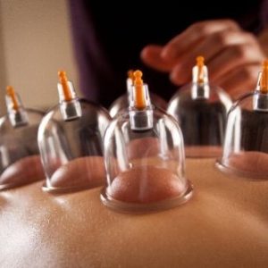 Cupping