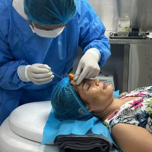 Liệu pháp nâng cơ thẩm mỹ bằng chỉ