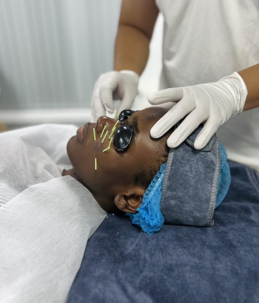 acupuncture therapy Hanoi for foreigners
