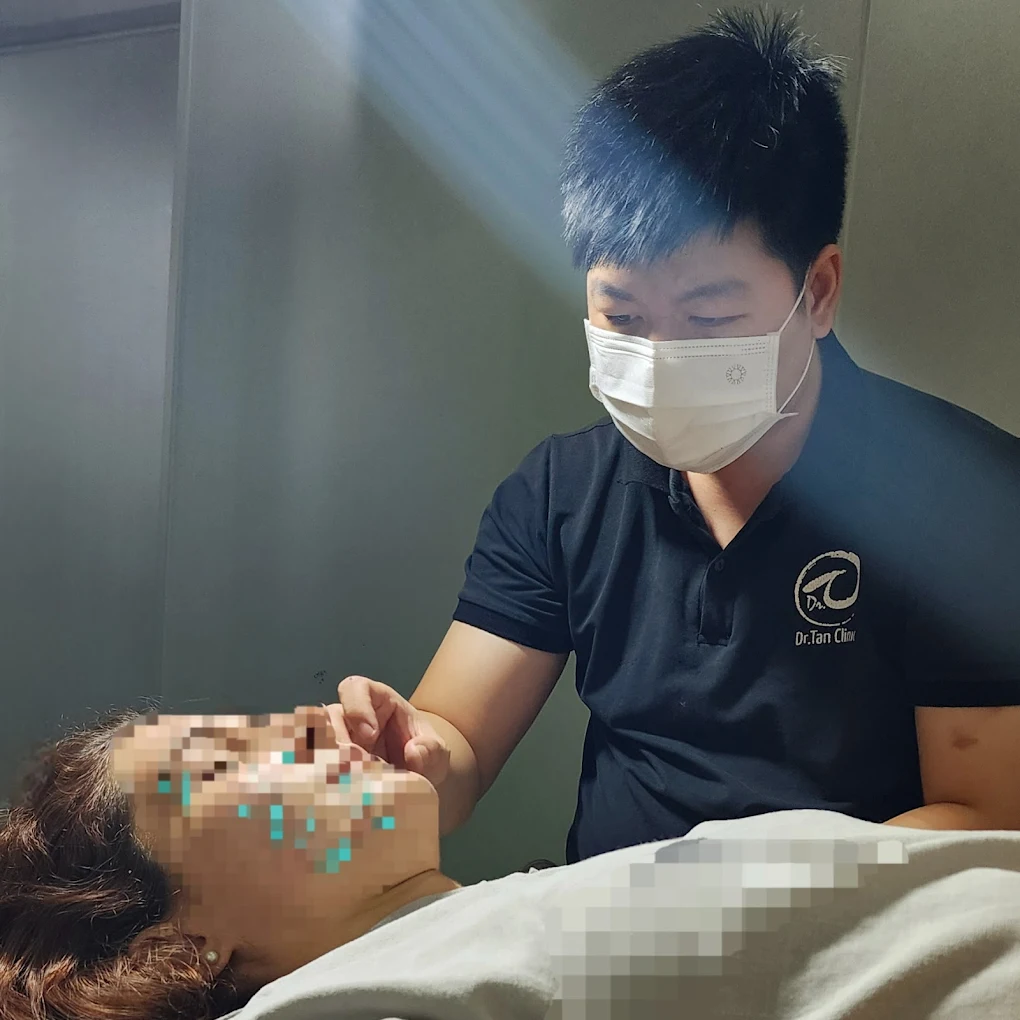 Châm cứu trị liệu tại Dr. Tan Clinic Hà Nội