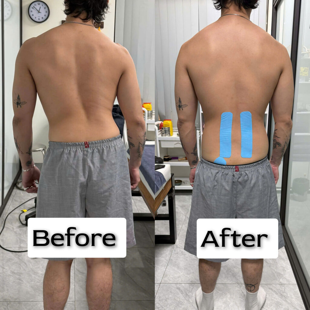 dan-kinesiostape-drtanclini