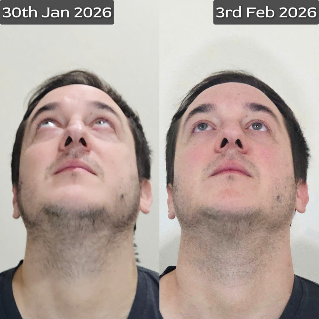 Nắn chỉnh khuôn mặt bằng tay tại Dr. Tan Clinic Hà Nội